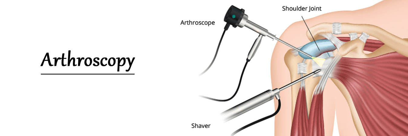 Arthroscopy Doctor In Jaipur