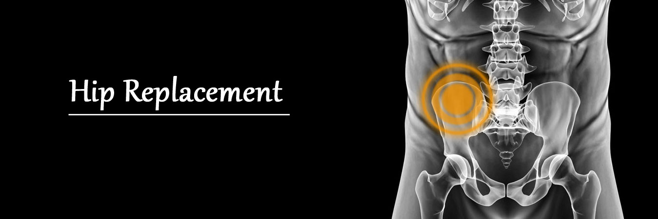 Hip Replacement Doctor In Jaipur