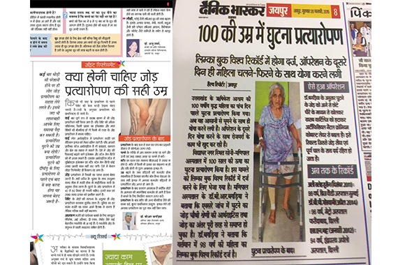 Knee Replacement Doctor